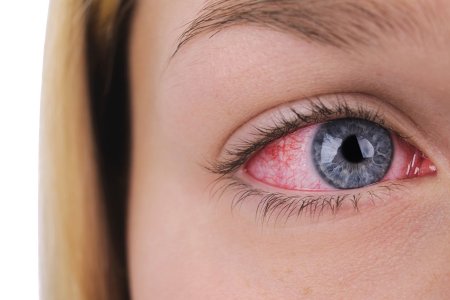 Доктор Александр Мясников указал на опасные причины покраснения глаз