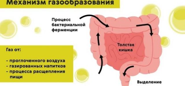 Какое лучшее лекарство от метеоризма