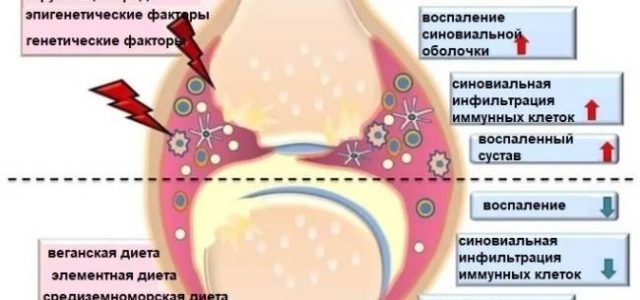 Лучшая диета при ревматоидном артрите