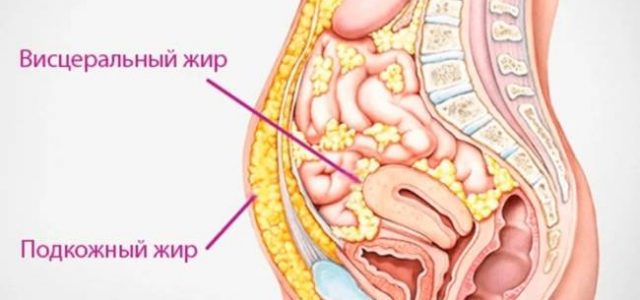 Опасность жира на животе у пожилых женщин