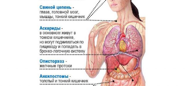 10 предупреждающих знаков о том, что в вашем теле полно паразитов