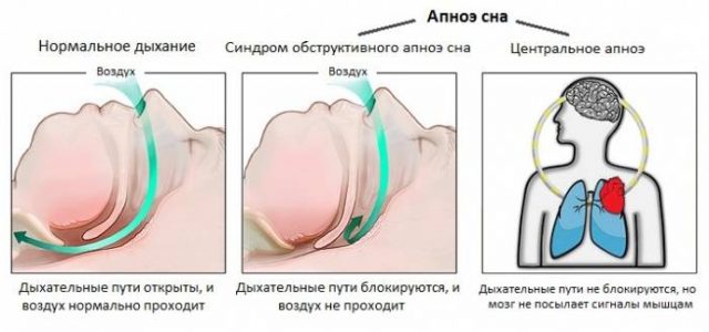 13 признаков того, что ваши почки нуждаются в помощи