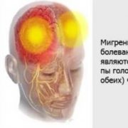 6 триггеров мигрени, которых нужно избегать