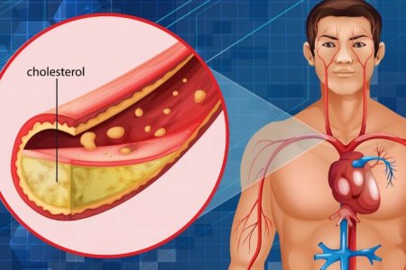 Врач Мясников рассказал, можно ли нормализовать уровень холестерина без лекарств
