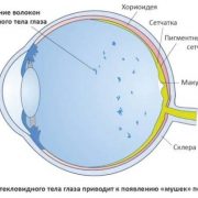 Мушки в глазах: симптомы, причины, лечение