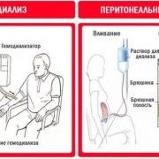 Различные виды диализа и их преимущества и недостатки