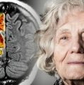 9 ранних сигналов болезни Альцгеймера