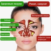 Как отличить насморк от инфекции пазух носа