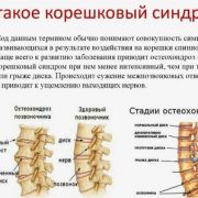 Патофизиология боли в спине